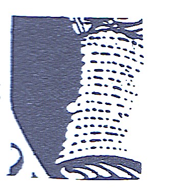 tort85.jpg