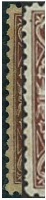 71denta.jpg